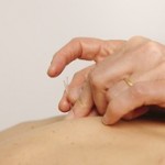 Acupuncture treatment being administered to a patient's back