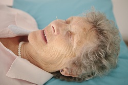 Older lady receiving facial acupuncture treatment.